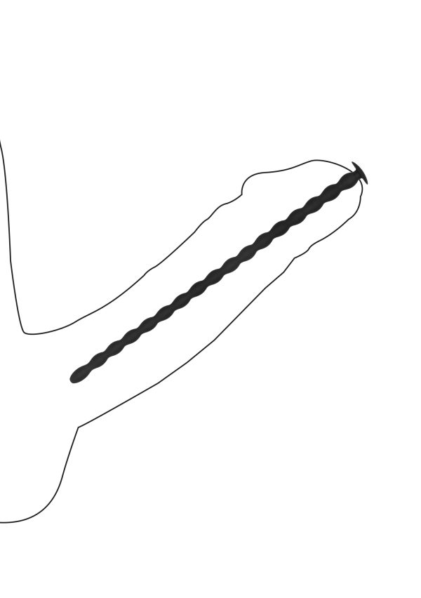 Lot de 4 Tiges pour Urètre Sporal Screw 30cm - Diamètres de 7 à 10mm – Image 3