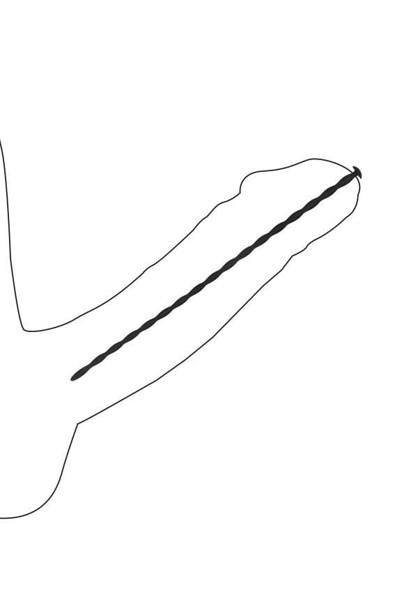 Pack de 4 tiges pour urètre Spiral Screw 30 cm - Diamètres de 3 à 6mm – Image 4