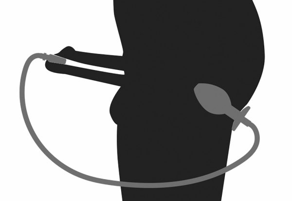 Plug Penis avec plug anal pour jeu Uro – Image 3